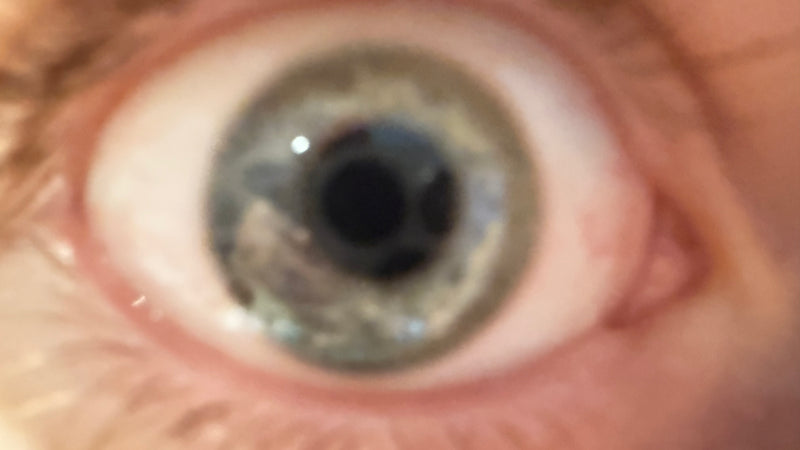 Blurry, or focused on the lashes