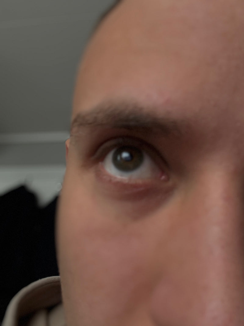 Too far away, the iris is tiny